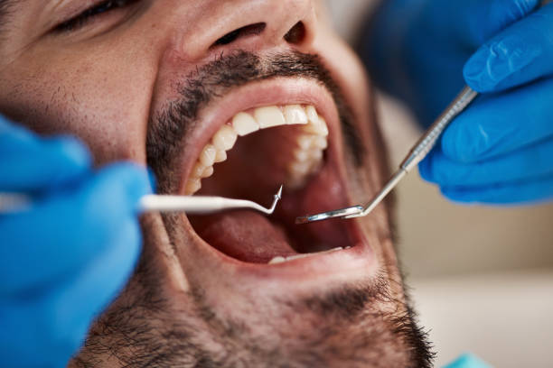 Best Broken or Cracked Tooth Emergency Dentist in Biola, CA